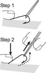 diagram of how to remove a fish-hook caught in skin